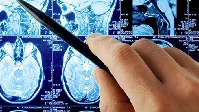 traumatic brain injury