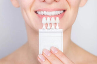 veneers redefining dental harmony through advanced materials