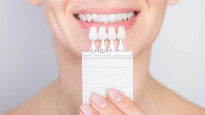 veneers redefining dental harmony through advanced materials