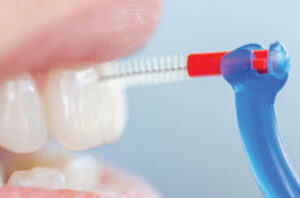 incorporating piksters interdental brushes into preventive programs