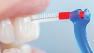 incorporating piksters interdental brushes into preventive programs
